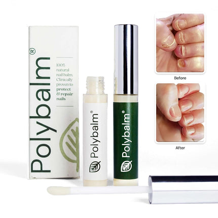 CLINICALLY PROVEN for Weak, Brittle Nails | All Natural Nail Repair Balm | Doctor Developed to Strengthen Nails Damaged by Chemotherapy, Gel or Nail Salon Manicures, Menopause & Aging | Made in the UK