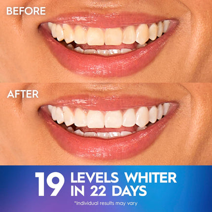 Teeth Whitening Strips,  3D Whitestrips Professional Effects, Enamel Safe Teeth Whitening Kit, 22 Treatments (44 Strips), Professional-Level Whitening, 19 Levels Whiter