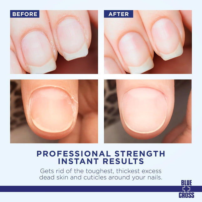 Cuticle Remover & Softener Liquid for Nails –  Professional Nail Care with Lanolin, Hydrating Treatment for Dry Cuticles & Hangnails, Made in USA, 6Oz
