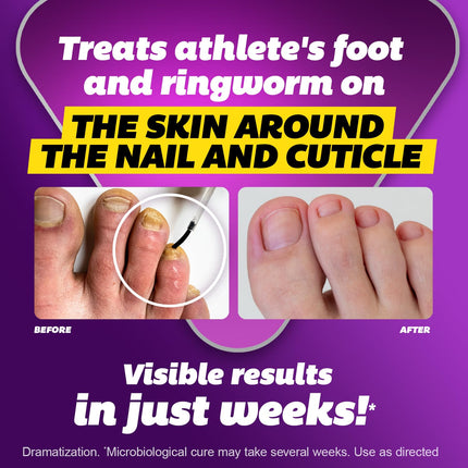 Max Strength Antifungal Liquid for Toenail Health with Brush Applicator, Results in 1 Week, Nail Fungus Treatment for Damaged Toenails, Athlete'S Foot Treatment, Tolnaftate 1% 0.45 Fl Oz