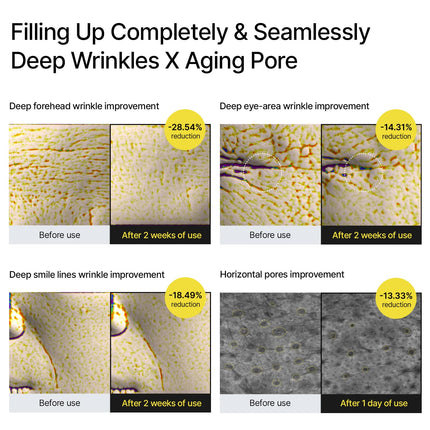 the Vita a Retinal Shot Tightening Booster | 0.1% Retinal, 3% Matryxyl, High-Strength Retinoid for Anti-Aging, Pore Minimizer, Wrinkles & Fine Lines, Firmer Skin, 15Ml, Korean Skin Care Gift