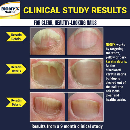 Fungal Nail Clarifying Gel | Clinically Proven for Discolored, Thick, Brittle, Yellow, Lifted, and Other Signs of Fungus-Damaged Toenails | 90% of Nails Improve | over 8 Million Sold