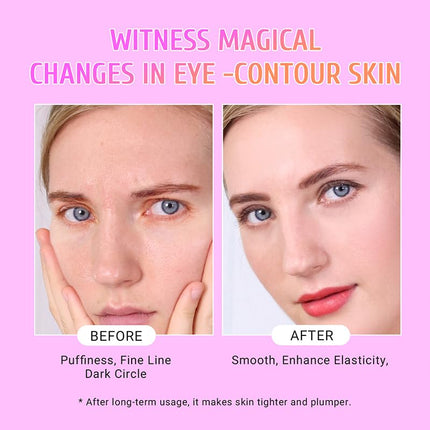 under Eye Patches Gold and Hyaluronic Acid for Puffy Eyes,Rose Eye Masks for Dark Circles and Puffiness Skin Care Smooth Wrinkles Products 30 Pairs