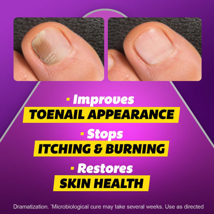Max Strength Antifungal Liquid for Toenail Health with Brush Applicator, Results in 1 Week, Nail Fungus Treatment for Damaged Toenails, Athlete'S Foot Treatment, Tolnaftate 1% 0.45 Fl Oz