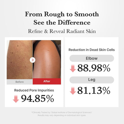 Body Peel Shot with Hypochlorous Acid | Gentle Body Exfoliating Serum for Dead Skin Cells, Rough Patches & Uneven Texture | Rice Extract, Panthenol for Hydrating & Smoothing Care | 9.46 Fl.Oz