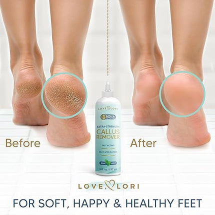 Extra Strength Foot Callus Remover Gel – Professional Foot Care Pedicure Treatment 6oz