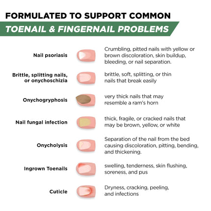 Toenail Fungus Treatment Extra Strength – Athletes Foot Treatment for Toenails, Restorative Nail Repair for Damaged Nails, Toenail Softener with Tea Tree Oil & Oregano Oil - Made in USA