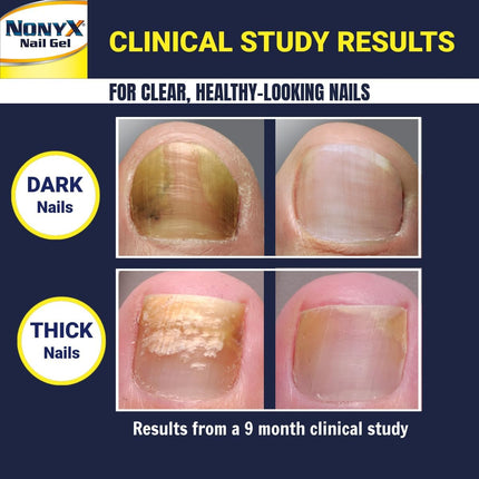 Fungal Nail Clarifying Gel | Clinically Proven for Discolored, Thick, Brittle, Yellow, Lifted, and Other Signs of Fungus-Damaged Toenails | 90% of Nails Improve | over 8 Million Sold