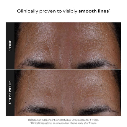 Paula’s Choice Skin Perfecting 2% BHA Liquid Exfoliant – Salicylic Acid Face Exfoliator for Clogged Pores, Blackheads & Fine Lines, Fragrance-Free Facial Treatment
