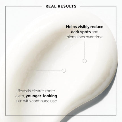 Microdermabrasion Total Renewal Face Scrub - Exfoliating Face Wash & Dark Spot Corrector for Sensitive Skin - Helps to Reduce the Appearance of Fine Lines & Even Skin Tone (2.5 Oz)