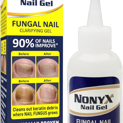 Fungal Nail Clarifying Gel | Clinically Proven for Discolored, Thick, Brittle, Yellow, Lifted, and Other Signs of Fungus-Damaged Toenails | 90% of Nails Improve | over 8 Million Sold