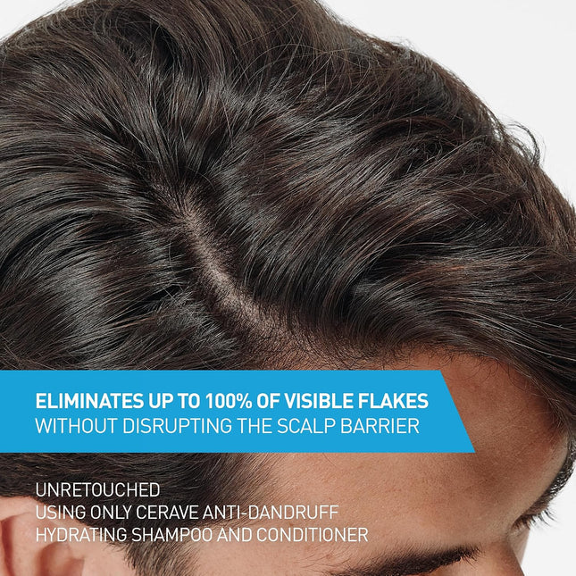 Hydrating anti Dandruff Shampoo, 1% Pyrithione Zinc Dandruff Treatment with Ceramides, Niacinamide & Hyaluronic Acid, Helps Eliminate Flakes & Provides Itchy Scalp Relief, Sulfate Free, 12 Oz