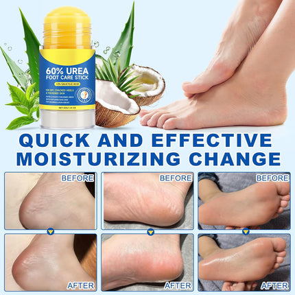 2 PCS Urea Stick 60% High Potency, Foot Care Urea Stick for Deeply Moisturizing & Fast Absorbing, Exfoliation for Dry Cracked Heels & Thickened Skin