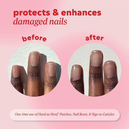 Hard as Hoof Nail Repair Patches - Nail and Cuticle Strengthening Treatment, Nail Strengthener and Growth, Nail Care, 20 Count