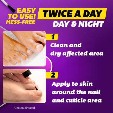 Max Strength Antifungal Liquid for Toenail Health with Brush Applicator, Results in 1 Week, Nail Fungus Treatment for Damaged Toenails, Athlete'S Foot Treatment, Tolnaftate 1% 0.45 Fl Oz